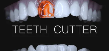 Teeth Cutter